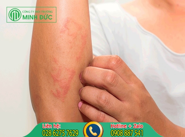 cách khử mùi bùn trong nước giếng khoan